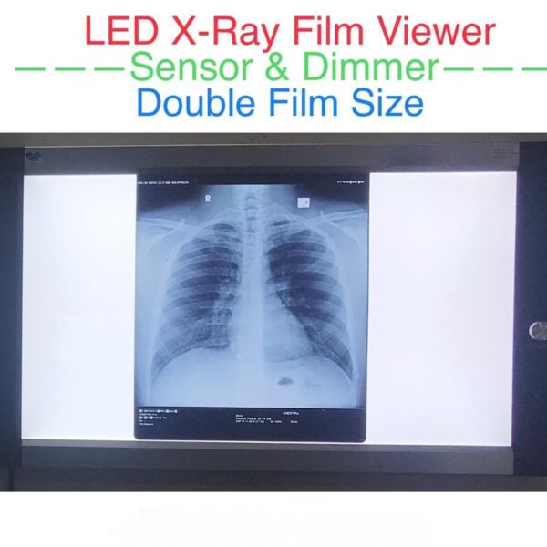 X-Ray Film Viewer Box Double